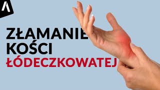 Złamanie kości łódeczkowatej I Jak długo zrasta się kość łódeczkowata [upl. by Sherrer]