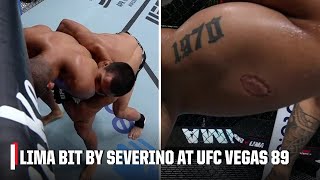 Igor Severino DQ’d for biting Andre Lima on UFCVegas89 prelims  ESPN MMA [upl. by Nitsa]