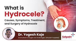 What is Hydrocele  Causes Symptoms Treatment and Surgery of Hydrocele  Dr Yogesh Kaje [upl. by Anitsirhc]