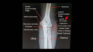 Elbow radiographic anatomy radiology [upl. by Anairol]