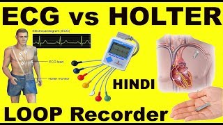 Rx Heart epi 11 h  How to Monitor Heart  ECG vs HOLTER vs LOOP recorder HINDI DrEducation [upl. by Westfahl725]