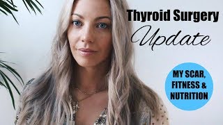 Thyroid Surgery Update  My scar fitness amp nutrition 1 year later [upl. by Suirtimid591]