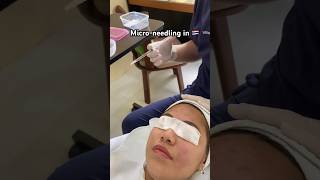 MicroNeedling in 🇹🇭 📍Chiang mai Peafowl 🦚 clinic 💚Would you do it beauty microneedling [upl. by Reyaht]