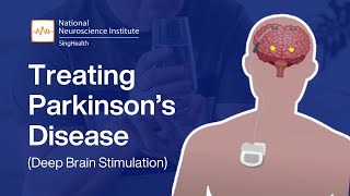 Parkinsons Disease Treatment Options  Deep Brain Stimulation DBS Explained [upl. by Sej84]