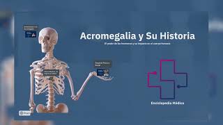 Video Presentación Sobre La Acromegalia Y Su Historia  Enciclopedia Médica [upl. by Oramug326]