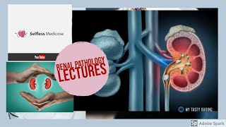 RENAL PATHOLOGY lecture 22 UROLITHIASIS made easy [upl. by Sally]