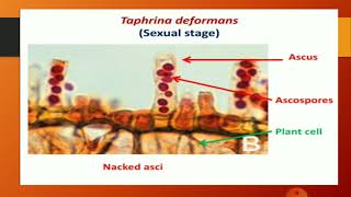 Taphrina deformans  Life Cycle By DrSmita Jain Associate Professor Botany [upl. by Shriner]