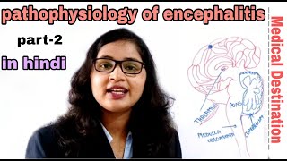 Encephalitis part2  pathophysiology  symptoms  treatment in hindi  medical Destination [upl. by Baumann]