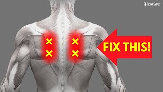 How to Fix Nerve Pain in the Shoulder Blades [upl. by Ayenet]