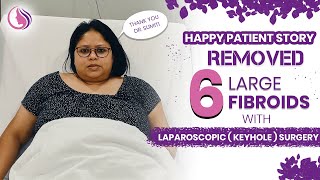 Happy Patient Story removed 6 large Fibroids with Laparoscopic Keyhole Surgery patienttestimonial [upl. by Acyssej]