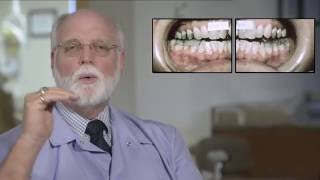 TMJ How Long Will Treatment Last [upl. by Notxam]