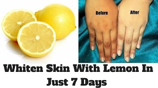 How To Whiten Skin With Lemon In Just 7 Days  Lemon Facial At Home  Lemon For Skin Whitening [upl. by Fishman325]