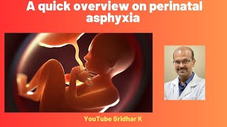 Perinatal asphyxia A quick overview asphyxia perinatalasphyxia birthasphyxia [upl. by Sabrina607]