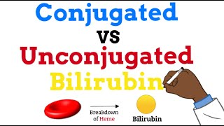 Conjugated vs Unconjugated Bilirubin  Simple Explanation [upl. by Yawnoc]