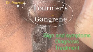 FOURNIER’S GANGRENE  FOURNIER GANGRENE  DR PRAVEEN PATIL [upl. by Diena]