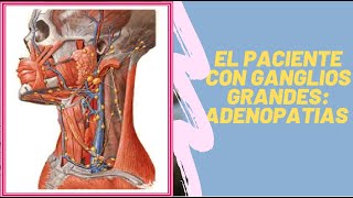 EL PACIENTE CON GANGLIO GRANDES ADENOPATIAS [upl. by Lib]