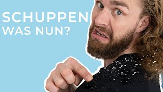 5 einfache TIPPS gegen Schuppen ● Haarstyling Tipps für Männer [upl. by Bunow]