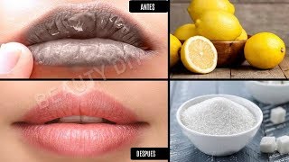 COMO ACLARAR Y ELIMINAR LA RESEQUEDA DE LOS LABIOS [upl. by Dodwell872]