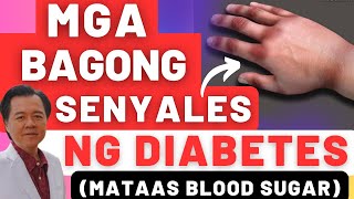 Mga Bagong Senyales ng Diabetes Mataas Blood Sugar  By Doc Willie Ong [upl. by Carmon5]