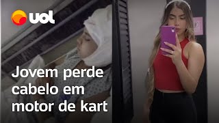 Adolescente é escalpelada andando de kart e perde 80 do couro cabeludo Vivo em hospital [upl. by Claudio]