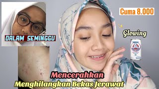 Memutihkan Dengan Cepat dan Menghilangkan Bekas Jerawat  DIY Masker Susu Beruang [upl. by Hasen]