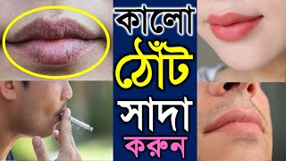 ঠোঁটের কালো দাগ দূর করার উপায়  কালো ঠোট গোলাপি করার সহজ উপায়  How to remove black spot of LIPS [upl. by Merton]