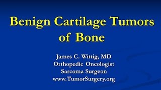 Orthopedic Oncology Course  Benign Cartilage Tumors Osteochondroma Chondroblastoma  Lecture 5 [upl. by Mindi655]