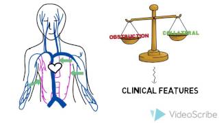 SVC Syndrome [upl. by Eanrahc]