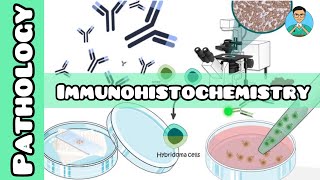 Immunohistochemistry  Pathology  USMLE NCLEX [upl. by Merrili]