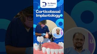 Discover the Power of Corticobasal Implantology  Fix Teeth in 3 Days  Dr Manoj Lokare Thane West [upl. by Ademordna513]