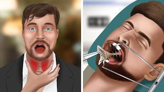 ASMR Animation Remove fish bones stuck in MrBeasts throat [upl. by Pembroke352]