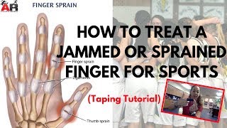 How To Treat a Jammed or Sprained Finger For Sports [upl. by Bertine664]