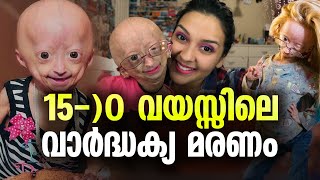 ചെറുപ്പത്തിൽ ബാധിക്കുന്ന അകാല വാർദ്ധക്യം ചികിത്സയില്ലാത്ത അപൂർവ രോഗം Adalia Rose Williams [upl. by Allanson]