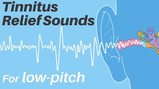 Tinnitus relief sounds  For lowpitch 65Hz  600Hz  Tinnitus Sound Therapy [upl. by Ednil995]