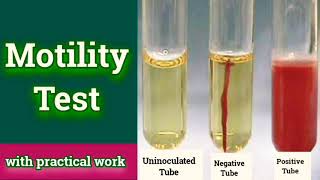 Motility test  Microbiology Microbial Biochemical test [upl. by Nur]