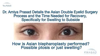 The Asian Double Eyelid Surgery Process and Why Temporary Swelling Occurs [upl. by Elletsirk604]