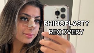 Rhinoplasty Recovery QampA [upl. by Nevins]