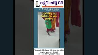 Severe Foot Deformities Treatment  Dr Lakshmi Narayana  FootDeformity OrthopedicCare Guntur [upl. by Sloane]