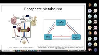 UofL Endocrinology Grand Rounds Dr Prasanthi Pasala Gandham [upl. by Web420]