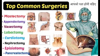 Top 15 Common Surgeries  You Should Know  mastectomy Appendectomy Lobectomyamp More [upl. by Annavoj]