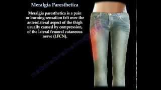 Meralgia Paresthetica  Everything You Need To Know  Dr Nabil Ebraheim [upl. by Sophronia]