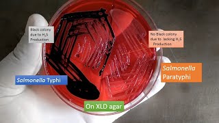 XLD agar having growth of Salmonella Typhi and paratyphi [upl. by Etra]