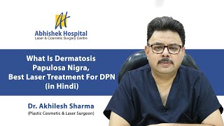 What Is Dermatosis Papulosa Nigra Best Laser Treatment For DPN In Hindi [upl. by Notterb]