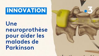 Une neuroprothèse révolutionnaire pour aider les malades de Parkinson [upl. by Twedy909]