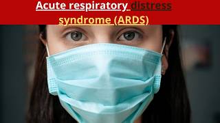 Acute respiratory distress syndrome ARDS [upl. by Sancha676]