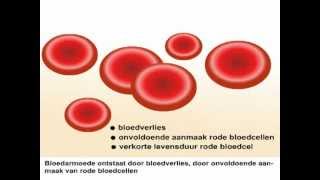 Bloedarmoede  Wat is bloedarmoede en wat zijn de symptomen [upl. by Mccullough]