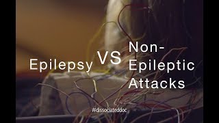 Epilepsy VS NonEpileptic Attacks Misdiagnosis amp Key Differences [upl. by Ranita]