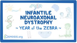 Infantile neuroaxonal dystrophy Year of the Zebra [upl. by Myrwyn]