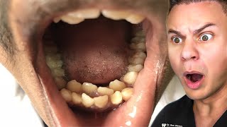 Orthodontist Reacts To The WEIRDEST Teeth On TikTok [upl. by Sinegold]