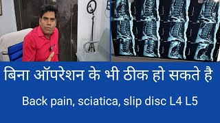 Back pain  sciatica  Slip Disc relief by chiropractic treatment [upl. by Hyo]